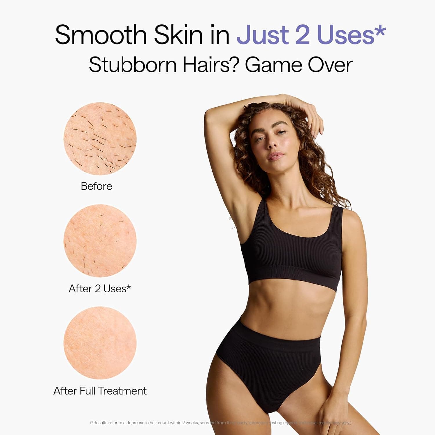 Ulike Air 10 IPL Hair Removal Device gallery