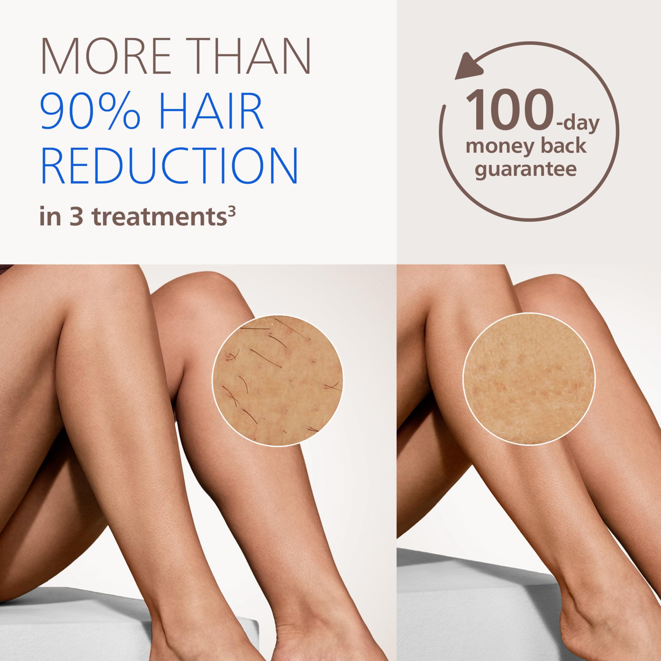 Philips Lumea IPL 9000 Series BRI984/03 listing image 3.