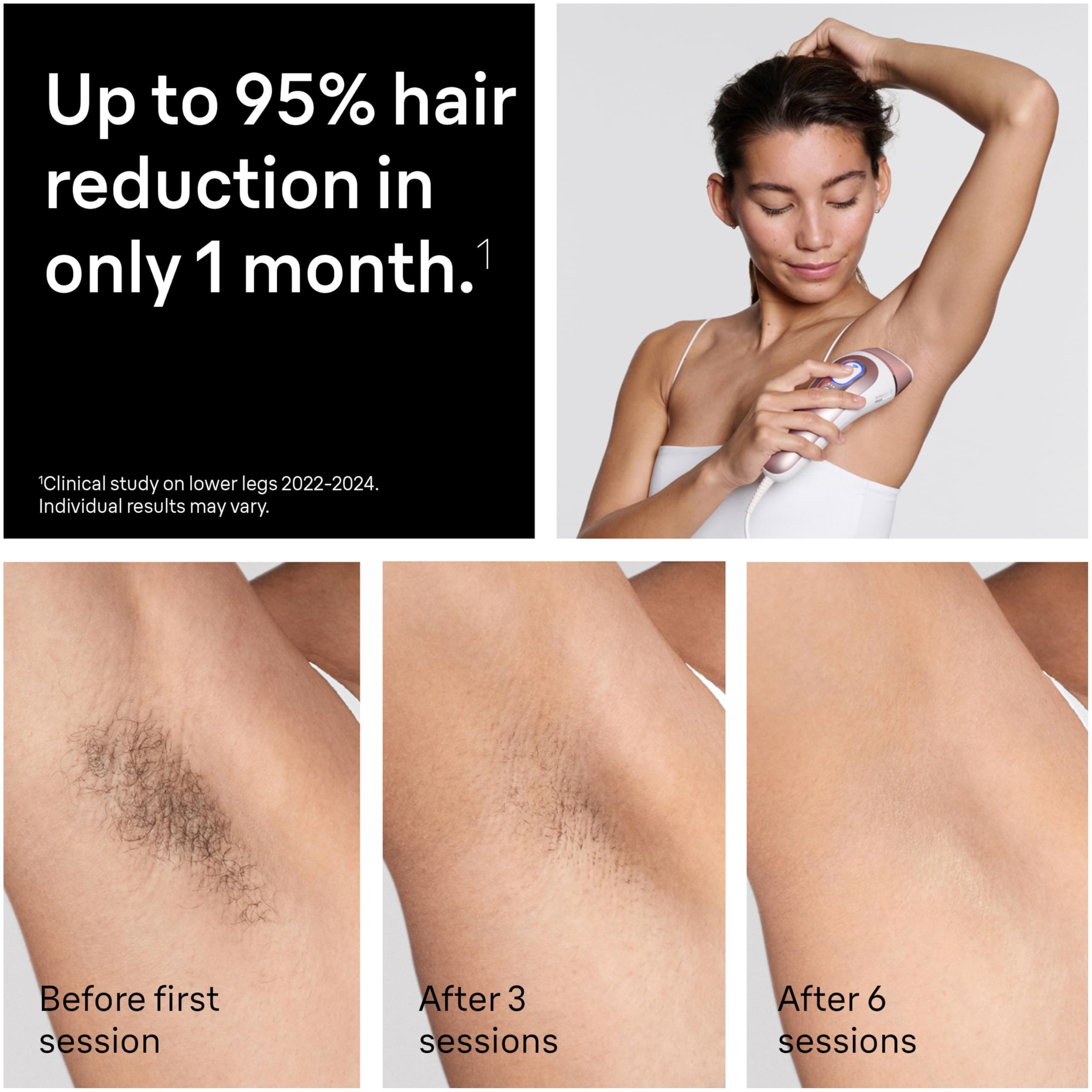 Braun Skin i-Expert Smart IPL PL7219 listing image 3.