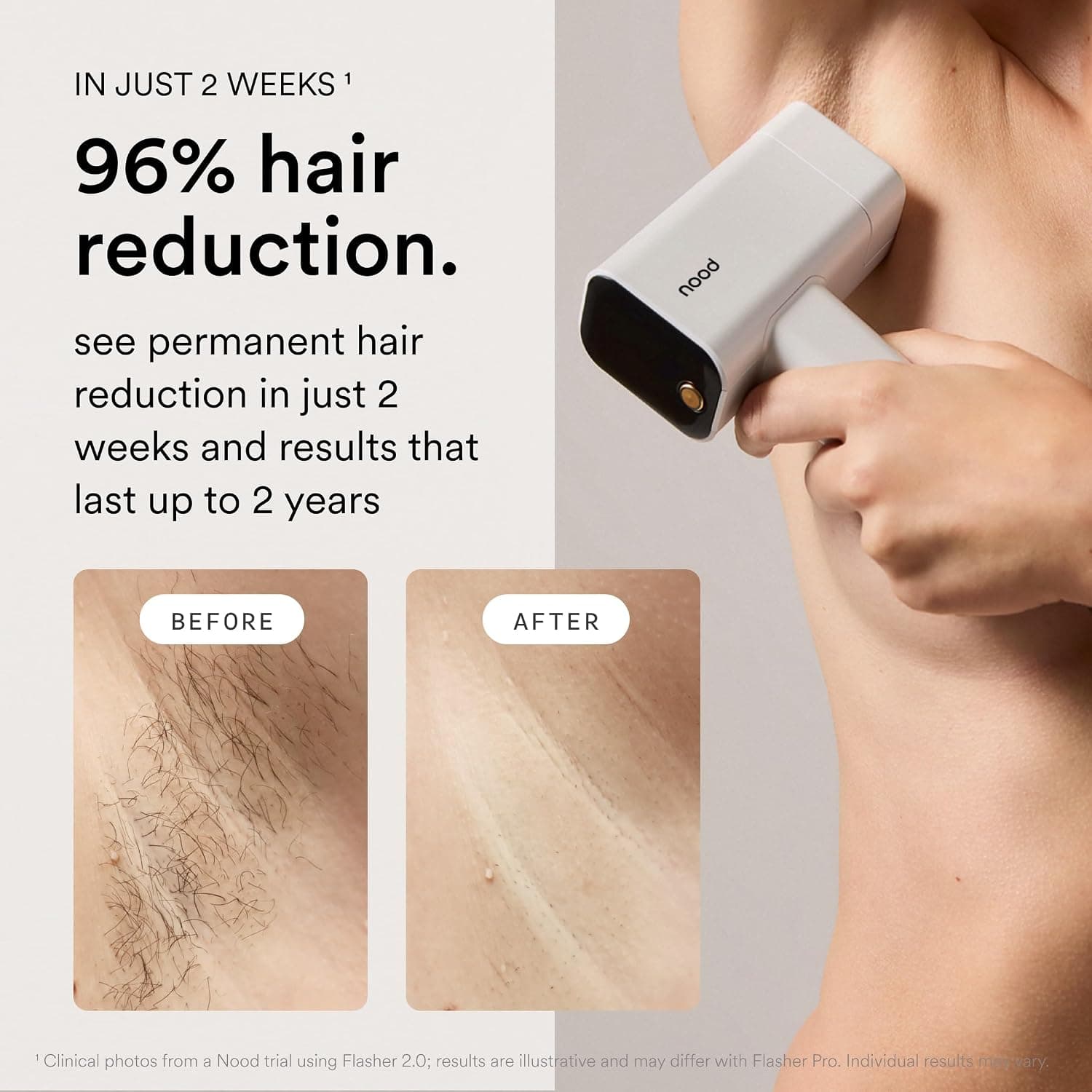 Nood Flasher Pro IPL official Amazon listing image 3