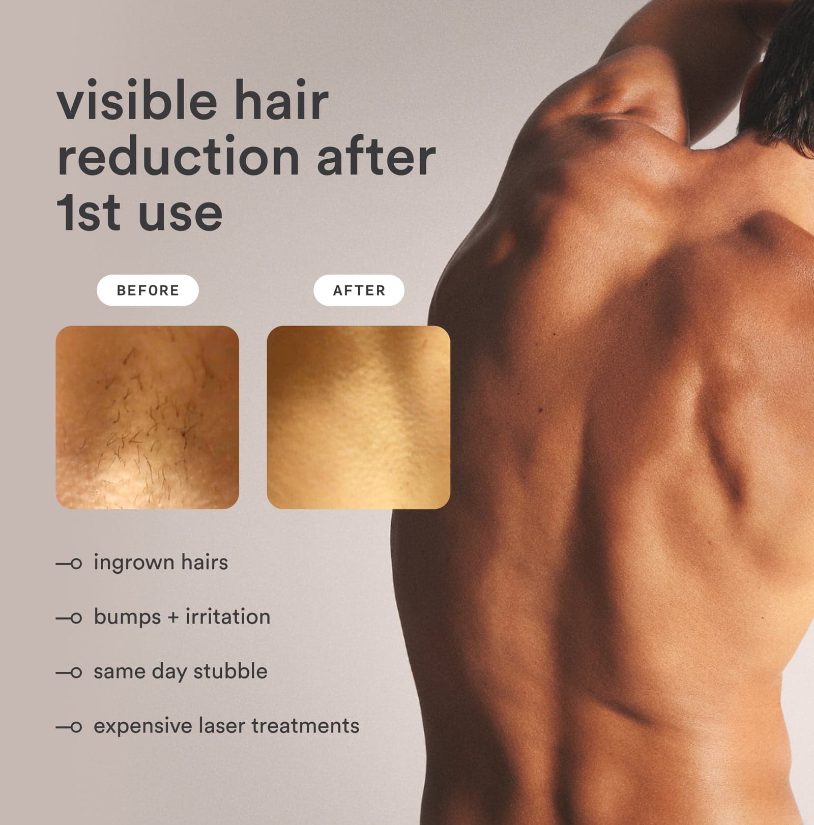 Nood Flasher Pro IPL official gallery image 2