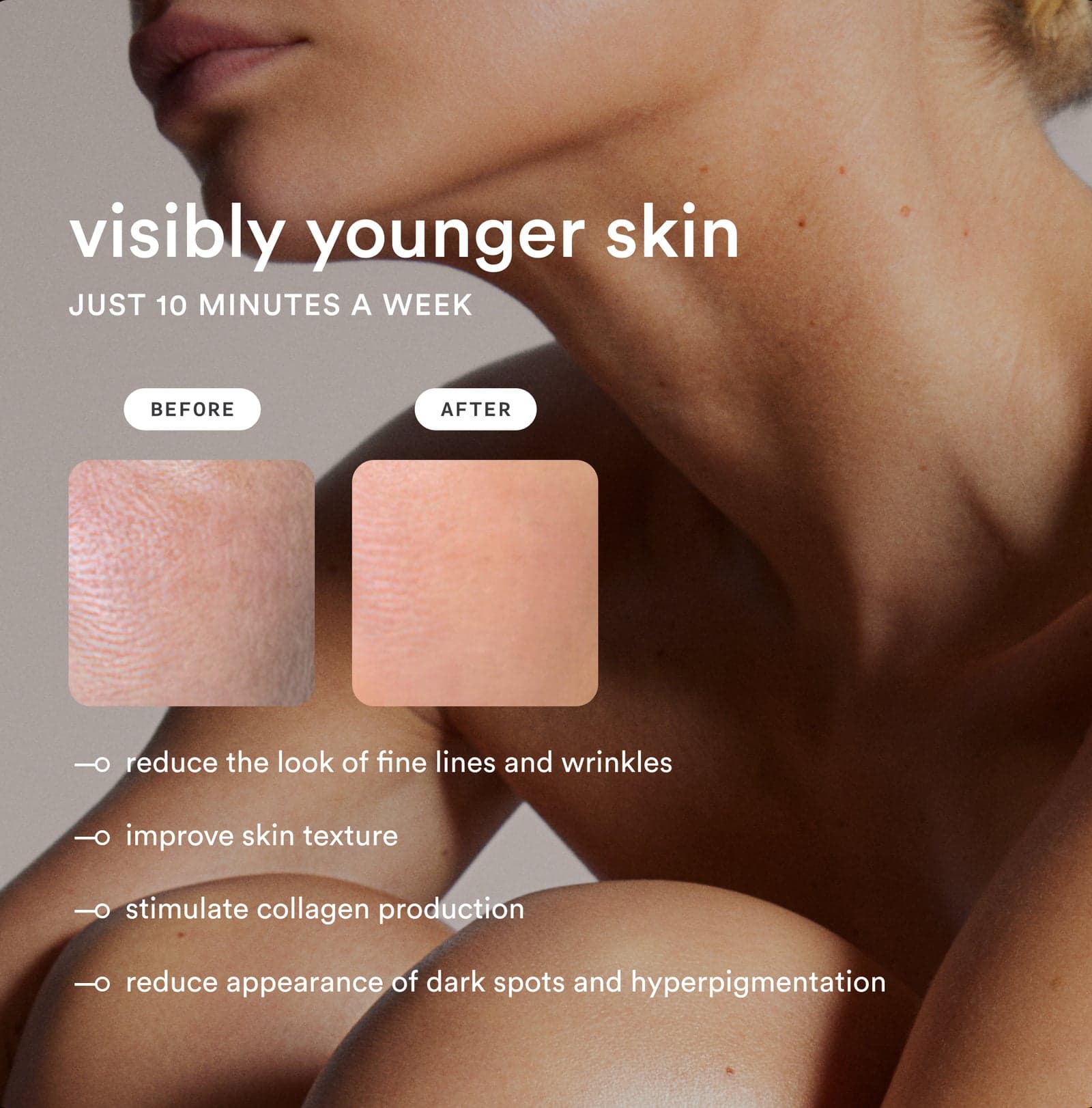Nood Flasher Pro IPL official gallery image 3