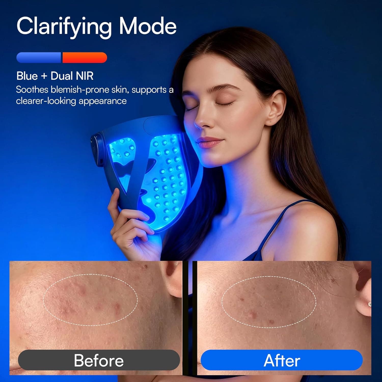 INIA GLOW 4D Wireless LED Mask official Amazon listing image 5