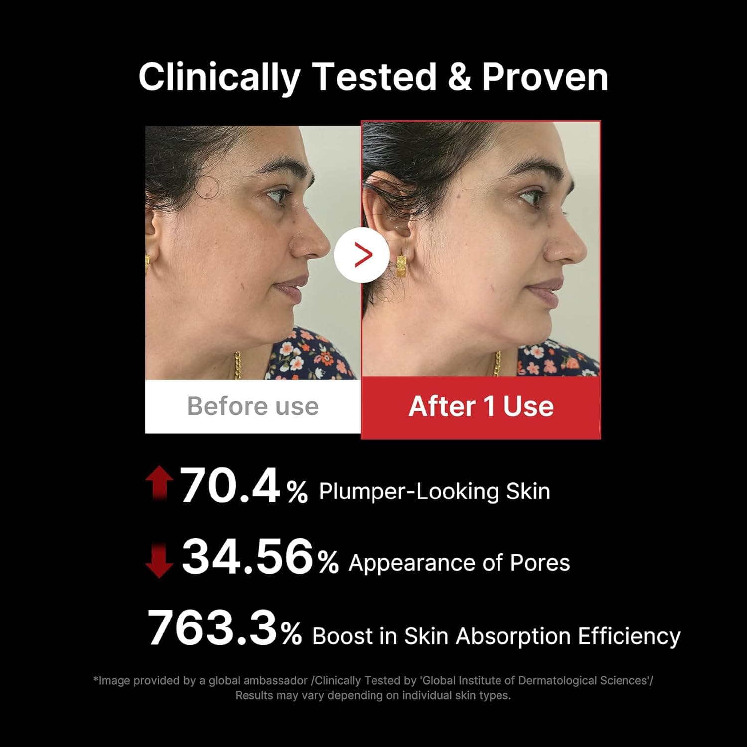 Example skin appearance imagery shown on the official listing